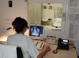 Guardo y Cervera tendrán nuevas salas y equipos de Rayos X en sus Centros de Salud radiografías digitales de última generación