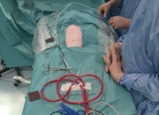 El Hospital público La Paz de la Comunidad de Madrid realiza el primer trasplante de intestino del mundo tras donación en asistolia