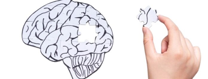 guardo demencia guardo demencia